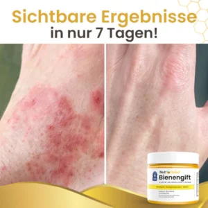 NutRelief™ Bienengift Ekzem Behandlung Creme