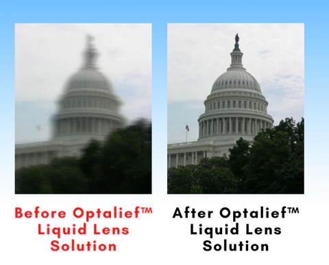 Optalief™ Liquid Lens Solution