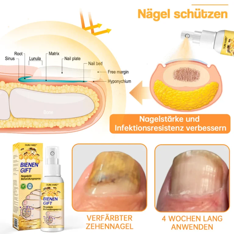 Ourlyard™ Bienengift Nagelpilz Behandlungsspray