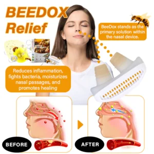 Oveallgo™ BeeDox Respiremedy Nasal Soothing Instrument