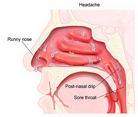 Oveallgo™ BeeDox Respiremedy Nasal Soothing Instrument