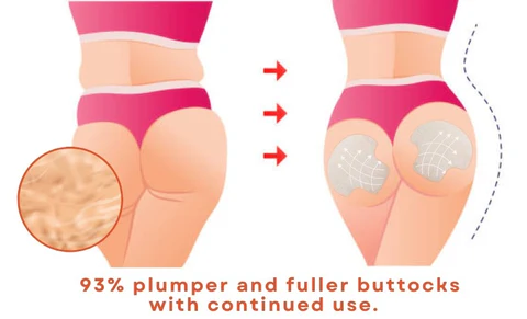 Oveallgo™ Butt-Lift Shaping Pads