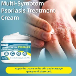 Oveallgo™ Multi-Symptom Psoriasis Treatment Cream