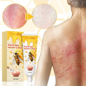 Oveallgo™ PsoriX Bee Venom Cream