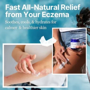 Oveallgo™ The Ocean Eczema Natural Soothing Cream