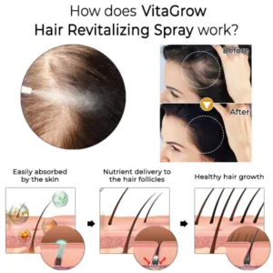 Oveallgo™ VitaGrow Hair Revitalizing Spray