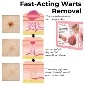 Oveallgo™ Wart NanoPURI Removal Rose Oil Soap