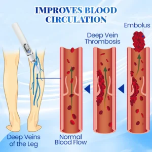 PosrystTM Blue Light Therapy Set for Varicose Veins