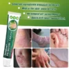 PsoriaGone™ Natural Herbaceous Plants Psoriasis Cream