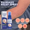 PsoriaGone™ Psoriasis relief spray