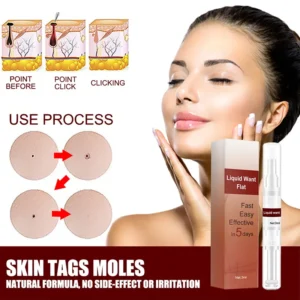 ReYouthBio™ Tags & Moles Remover