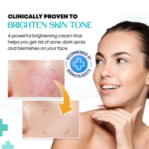 SilkenGlow™ Brighten Anti-acne Cream