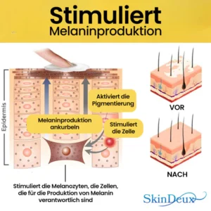 SkinDeux™ Bienengift Vitiligo Creme