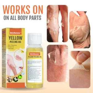 SkinRenew™ Yellow Peeling Oil