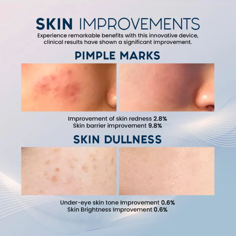 SkinRevive™ 5mins Collagen Booster - Image 6