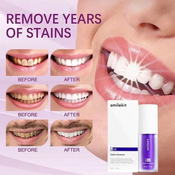 Smilekit™ Deluxe Herbal Teeth Whitening Mousse - Image 2