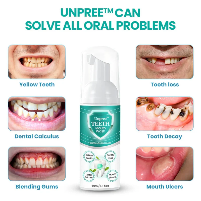 UNPREE™ Daily TEETH Mouthwash Foam - Solve All Oral Problems