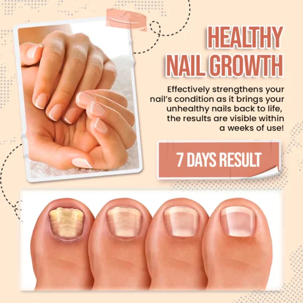 Zakdavi™️ 7 Days Nail Growth and Strengthening Serum