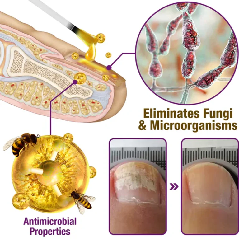 Oveallgo™ FungiFree Bee Venom Nail Treatment Serum