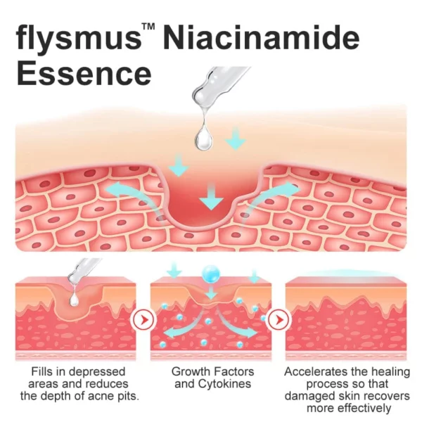 flysmus™ Niacinamide Pockmark Repair Essence - Image 3