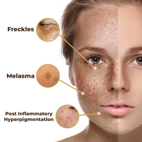 flysmus™ PeptideLuxe Melanin Vanish Serum - Image 5