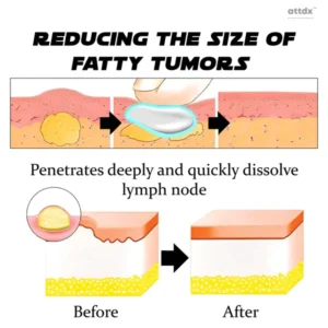 ATTDX LymphNode SculptingDrainage DetoxCream