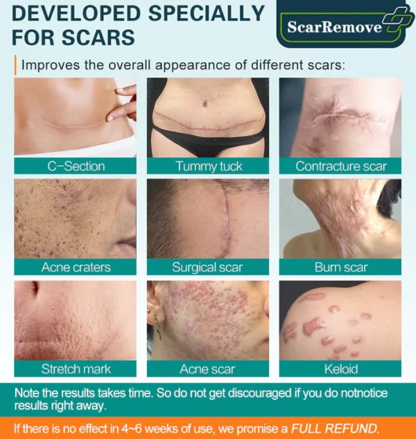 Advanced Scar Spray For All Types of Scars - Image 6