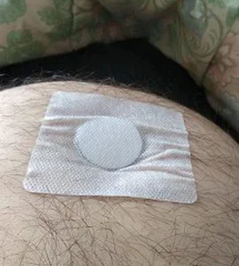 BLUESKY Prostate Treatment Patch