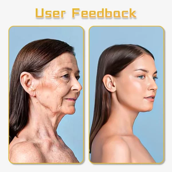 Biancat™ UltraRenew Ultrasonic Facelift Device