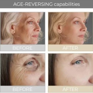 CC™ 30 Days Advanced Collagen Boost Anti-Aging Botox Face Serum