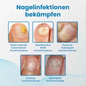 Ceoerty™ Anti-Paronychia Nagelbehandlungs-Gel