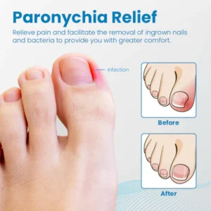 Ceoerty™ Anti-Paronychia Nail Treatment Gel