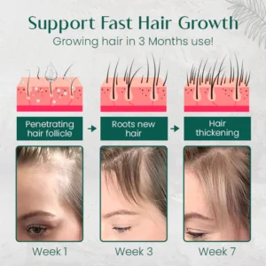 Ceoerty™ HairRenew Pro Growth Serum