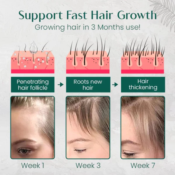 Ceoerty™ HairRenew Pro Growth Serum