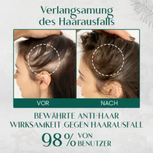 Ceoerty™ HairRenew Pro Wachstumsserum