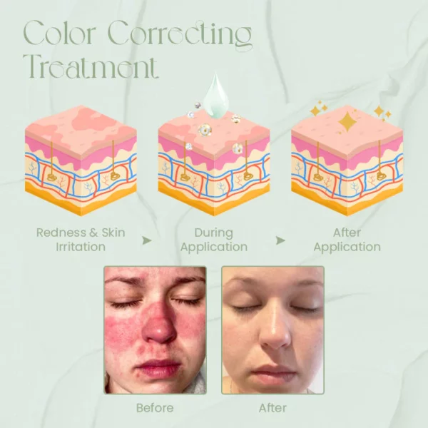 Ceoerty™ ToneTreat Skin Correcting Treatment Cream