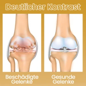 Ceoerty™ VitaFlex Gelenk- und Knochenpflege-Creme