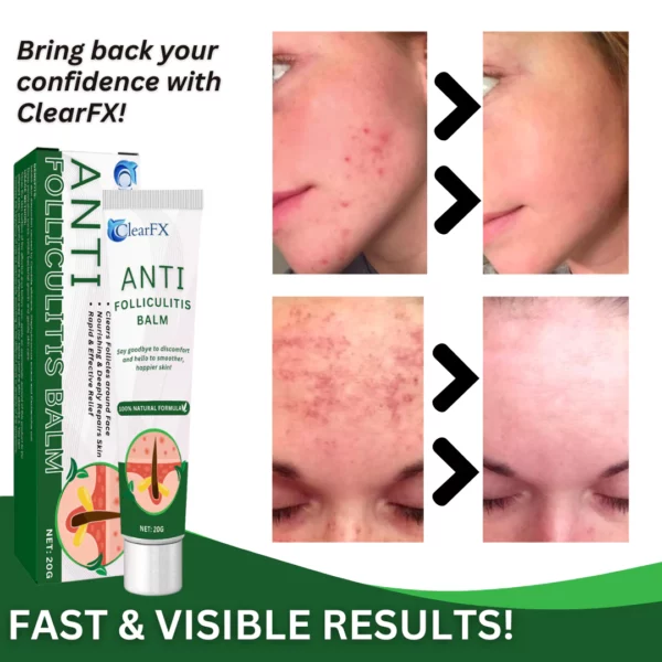 ClearFX™ Anti-Follikulitis-Balsam