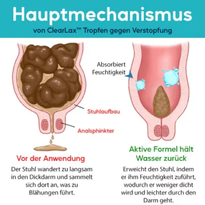 ClearLax™ Tropfen gegen Verstopfung