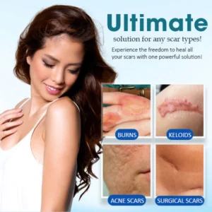 Cuzvc™ Scar Removal Gel