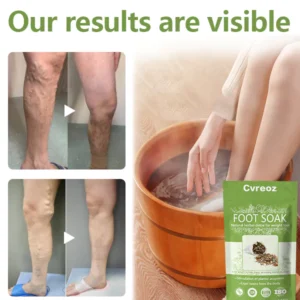 Cvreoz™ Herbal Detox Slimming Foot Therapy Pack