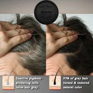 Esrever™ Rapid Gray Hair Reversing Fo-Ti Bar