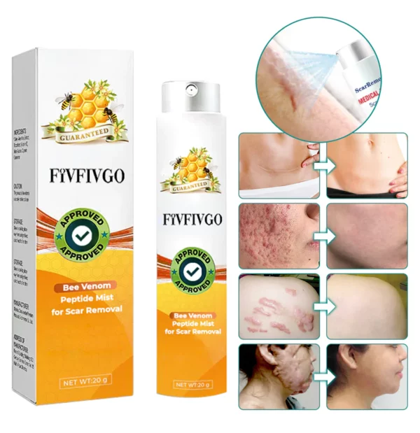 Fivfivgo™ Bienengift-Peptid-Nebel zur Narbenentfernung