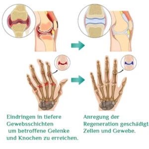 Futusly™ Turmalin Arthro- und Knochentherapie-Armband