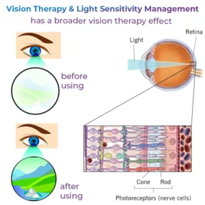 GFOUK™ Eye Therapy Patch