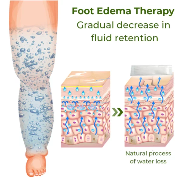 GFOUK™ Foot Edema Therapy Patch