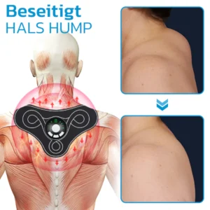 GFOUK™ TENSTECH Akupunkturpunkte Lymphatische Beruhigung Hals Instrument