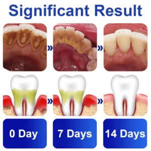 GFOUK™️ PureSmile Essence