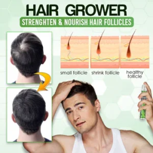 Herbal Hair-Growth Essence Spray