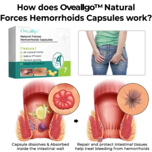 Natural Forces Hemorrhoids Capsules